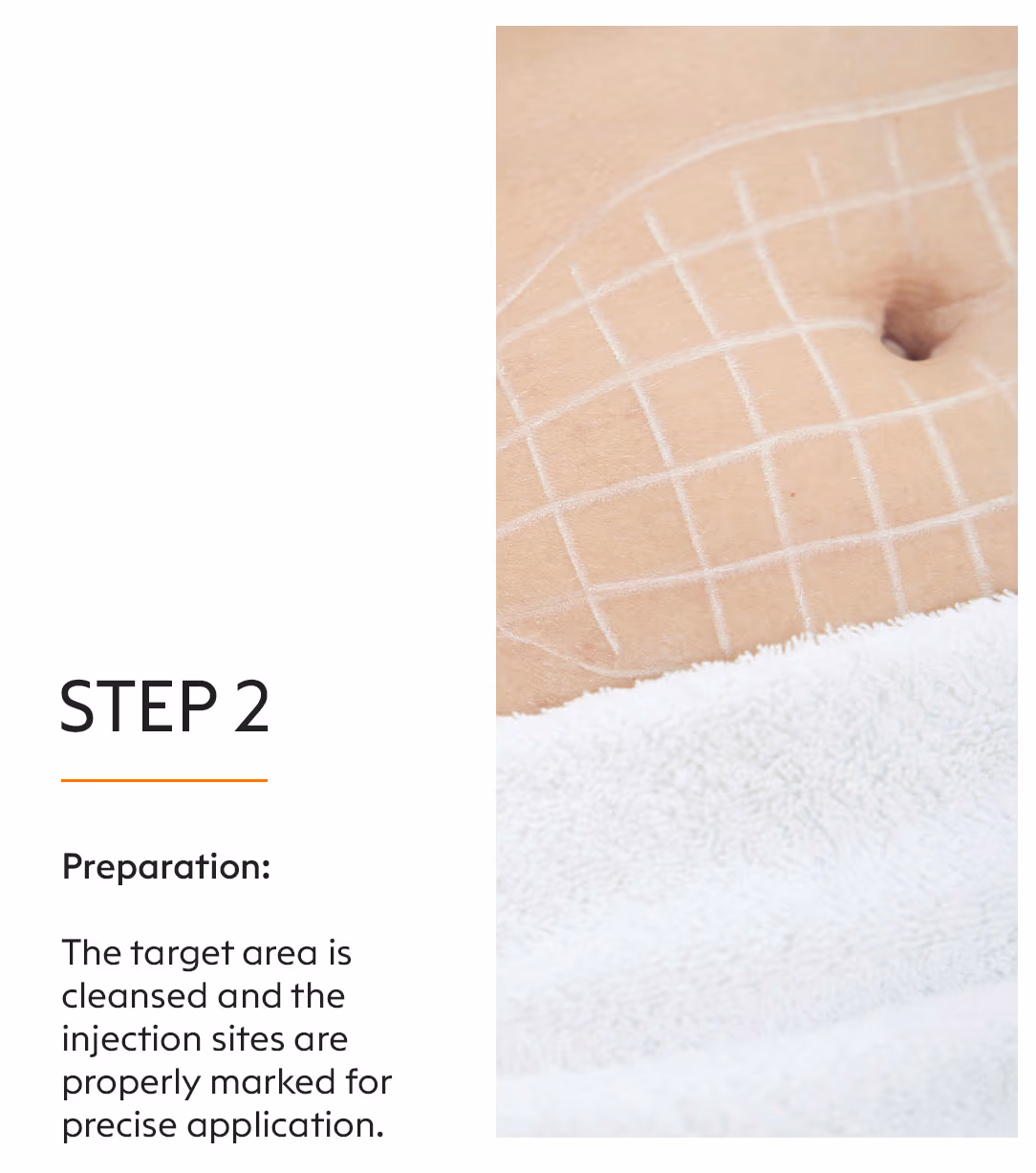 Fat Lipo Injectable 4
