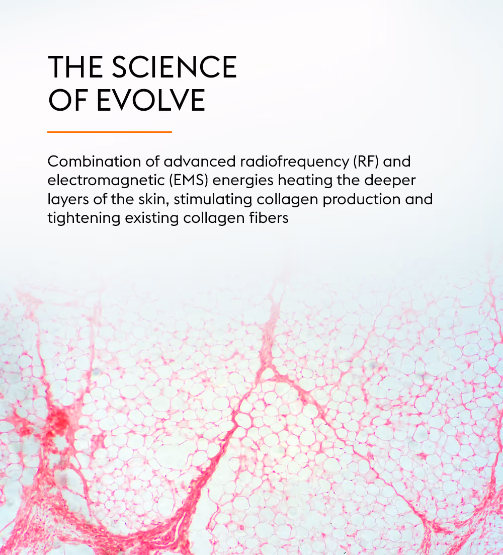 Evolve 2