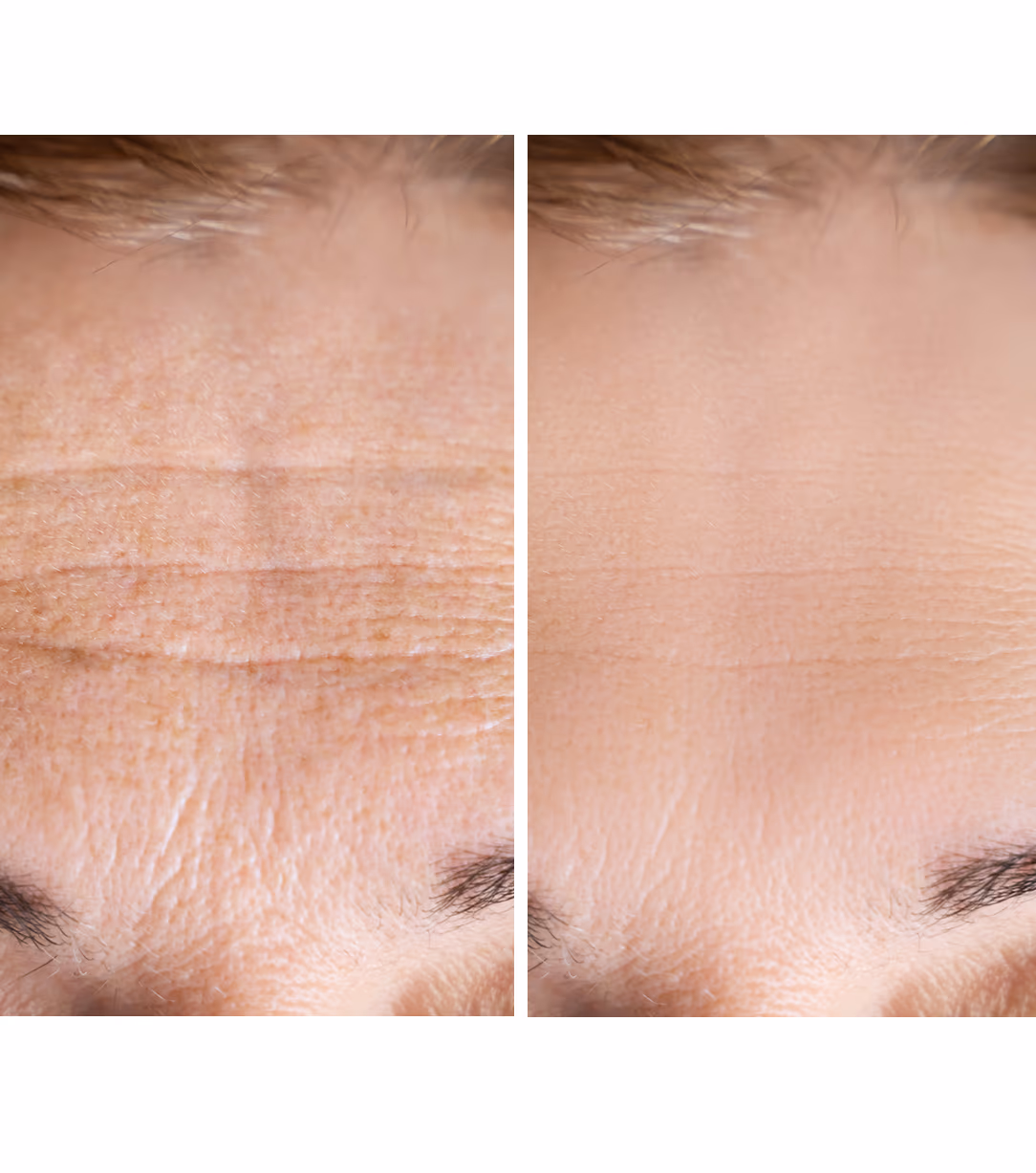 GFC Skin Whitening Treatment 1