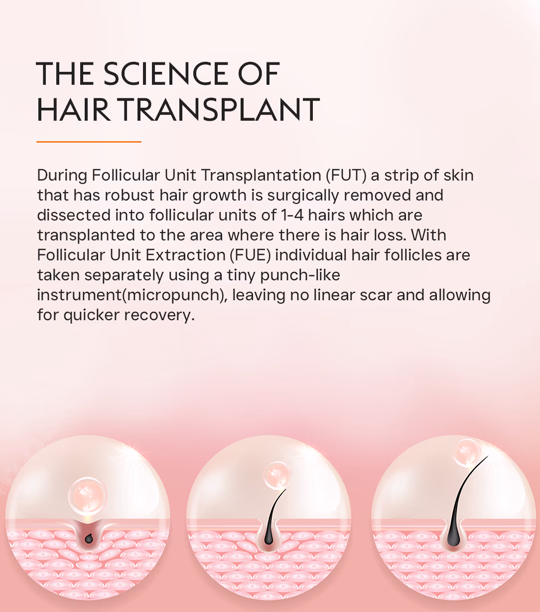 Hair Transplant Hair Fall Treatment 2