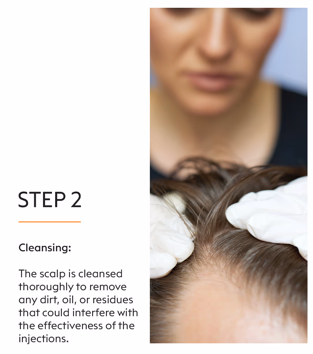 Meso Scalp 4