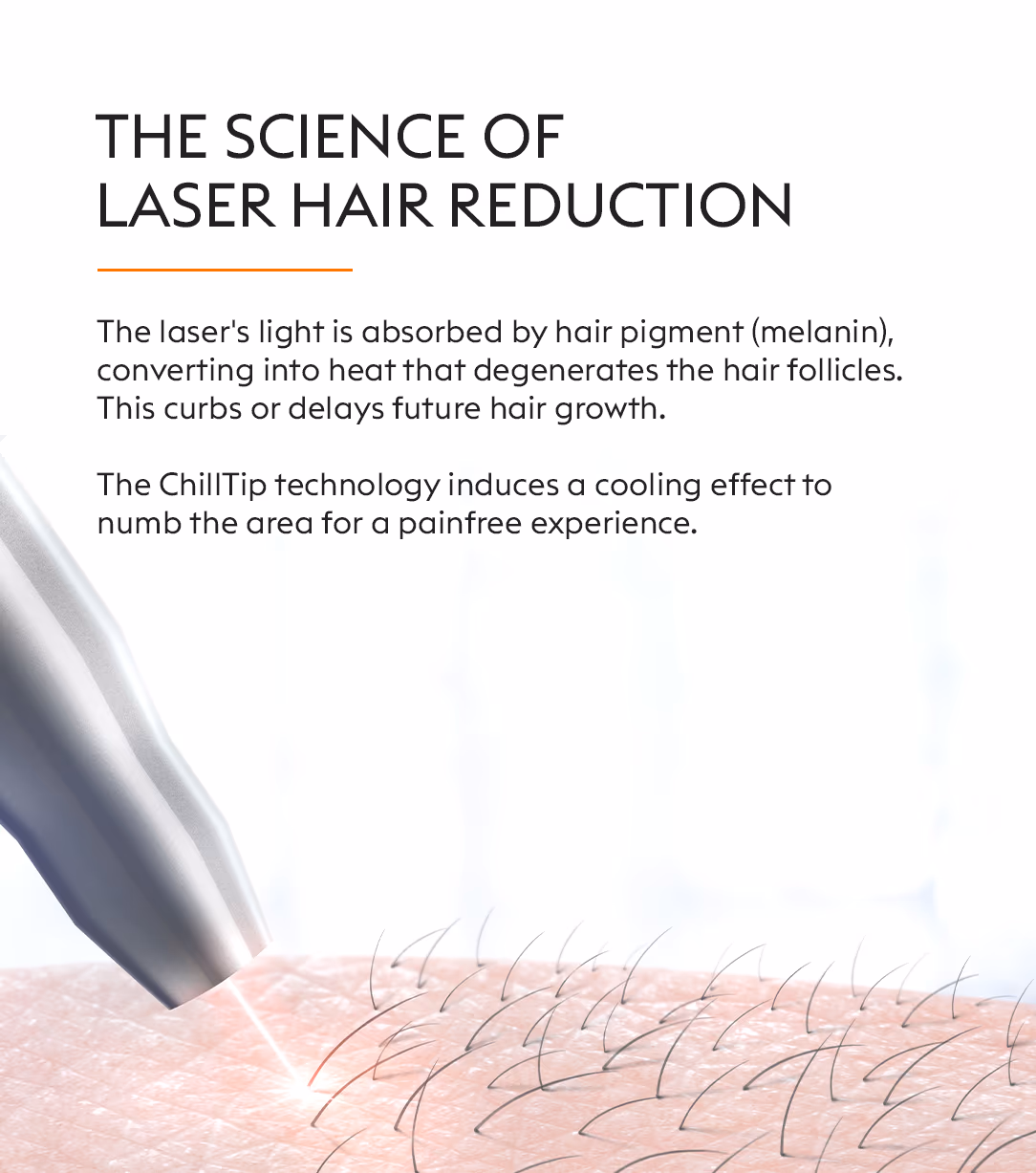 Full Body Laser Hair Removal Treatment 2