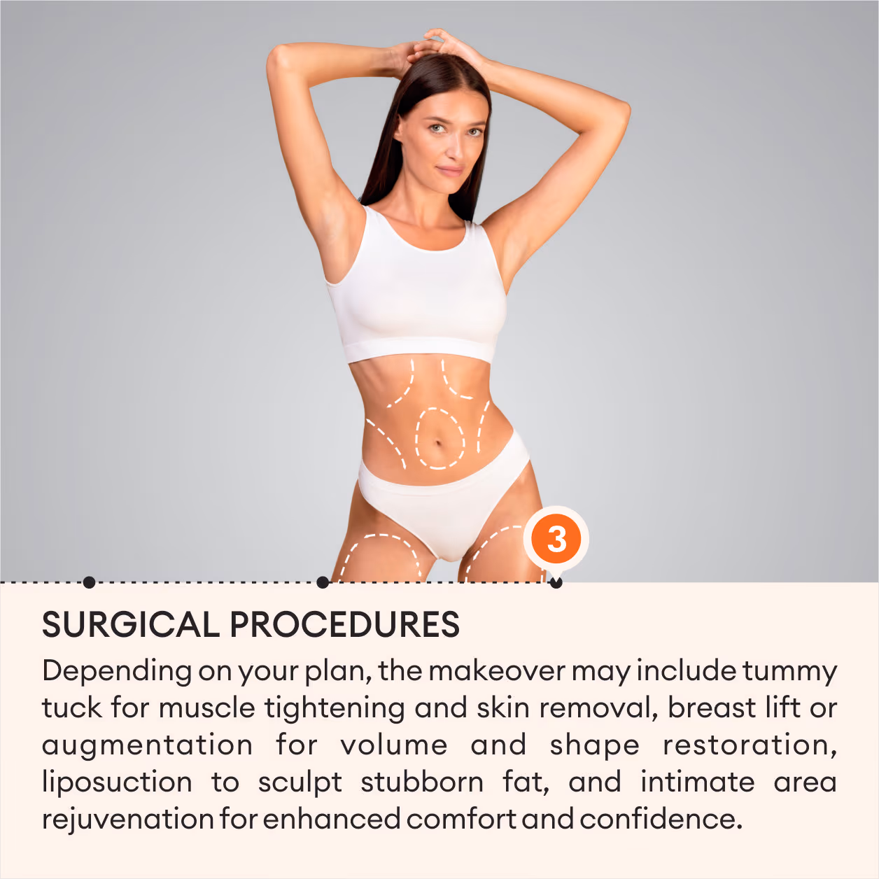 Mommy Makeover Surgery 6