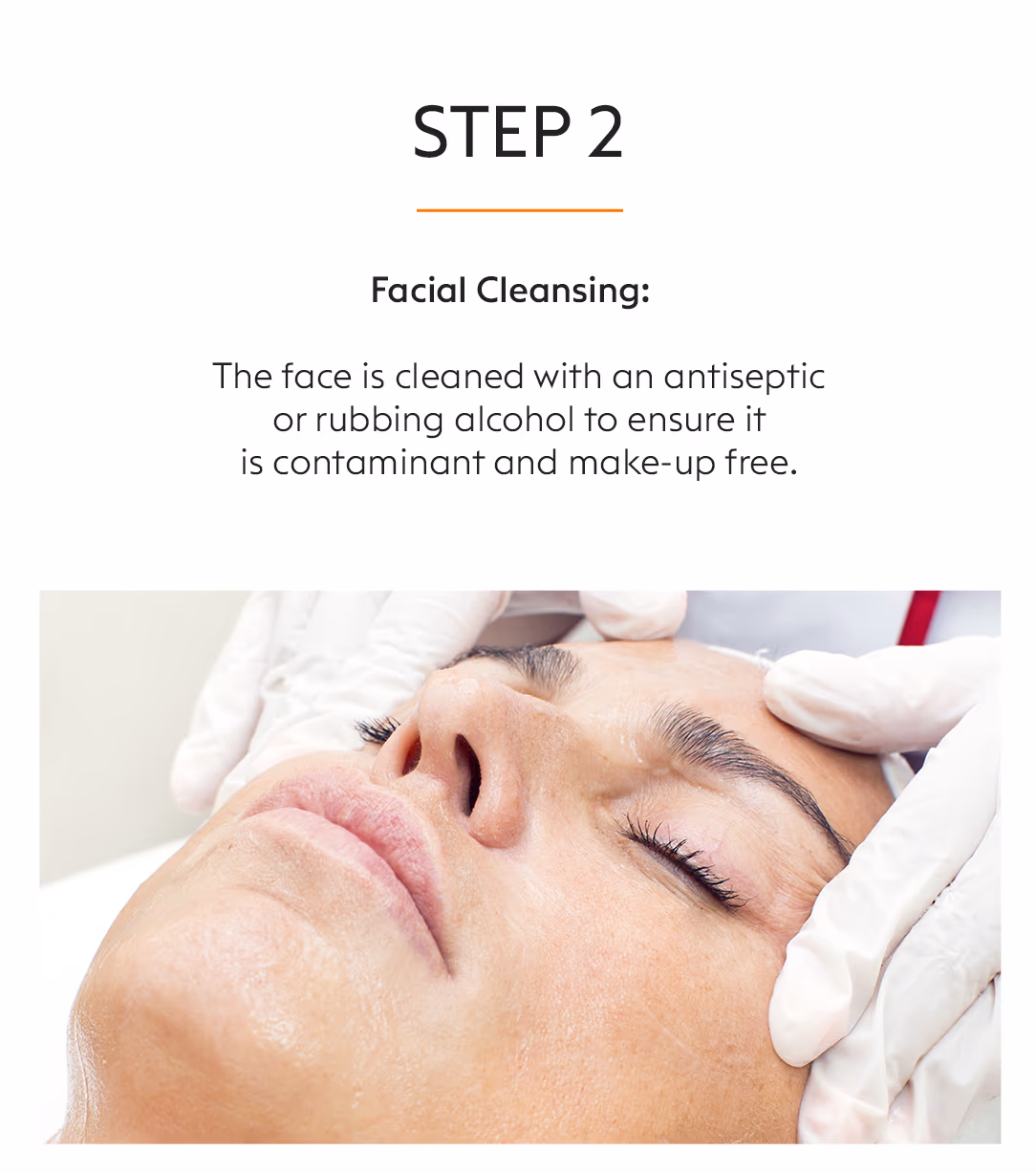 Face Fillers Injection Treatment 4