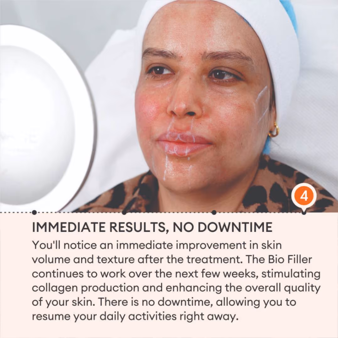 Bio Filler 6