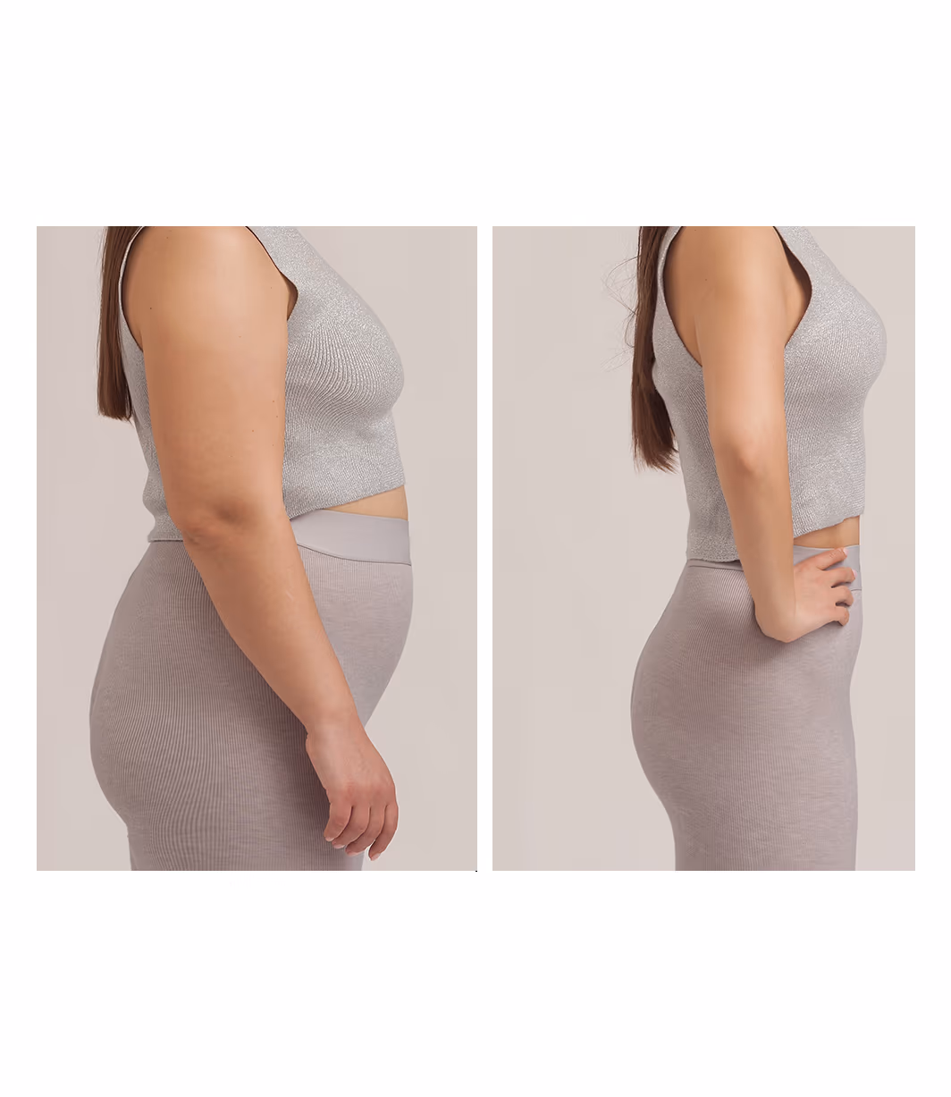Weight Loss & Inch Loss 1
