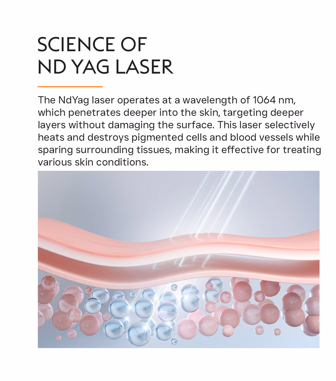 Nd Yag Laser Pigmentation Treatment 2