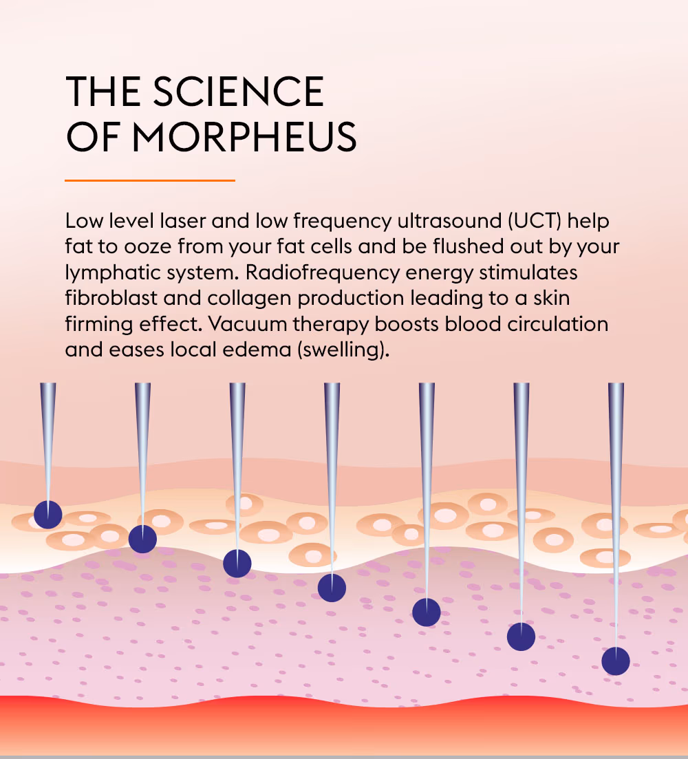 Morpheus 2
