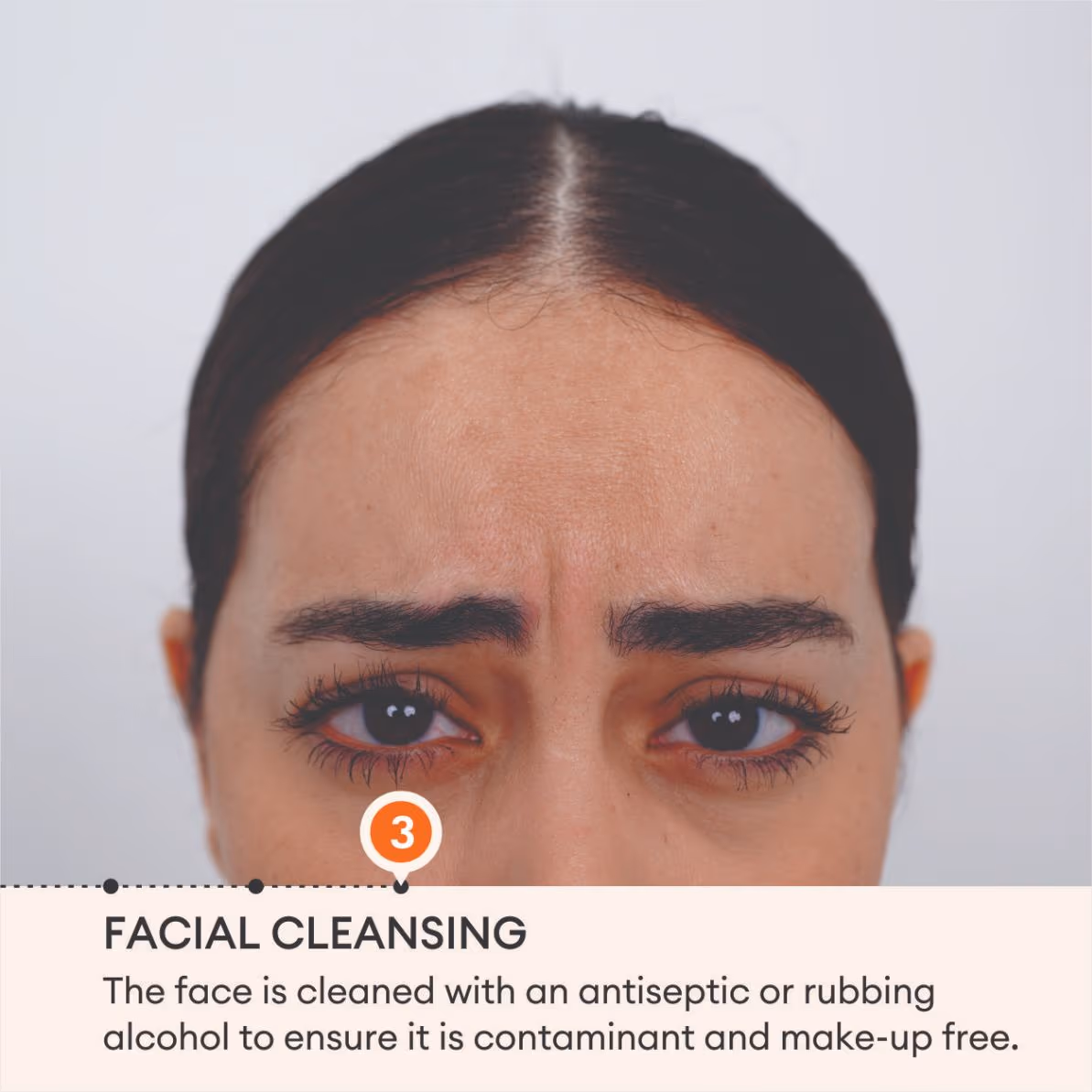 Botox 5