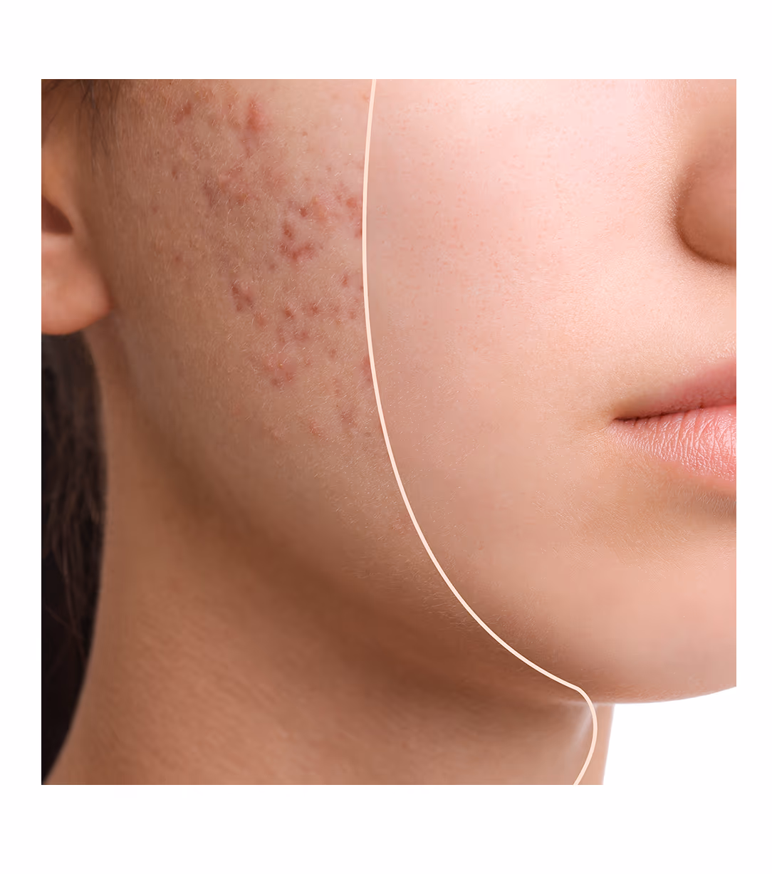 Kesar and Chandan Facial 1