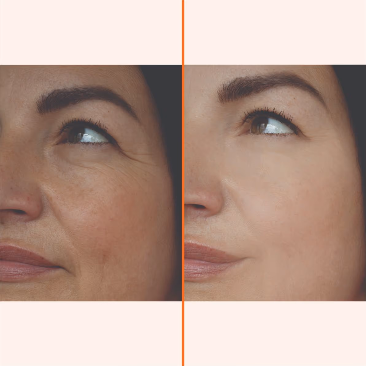 Eximia Face 1