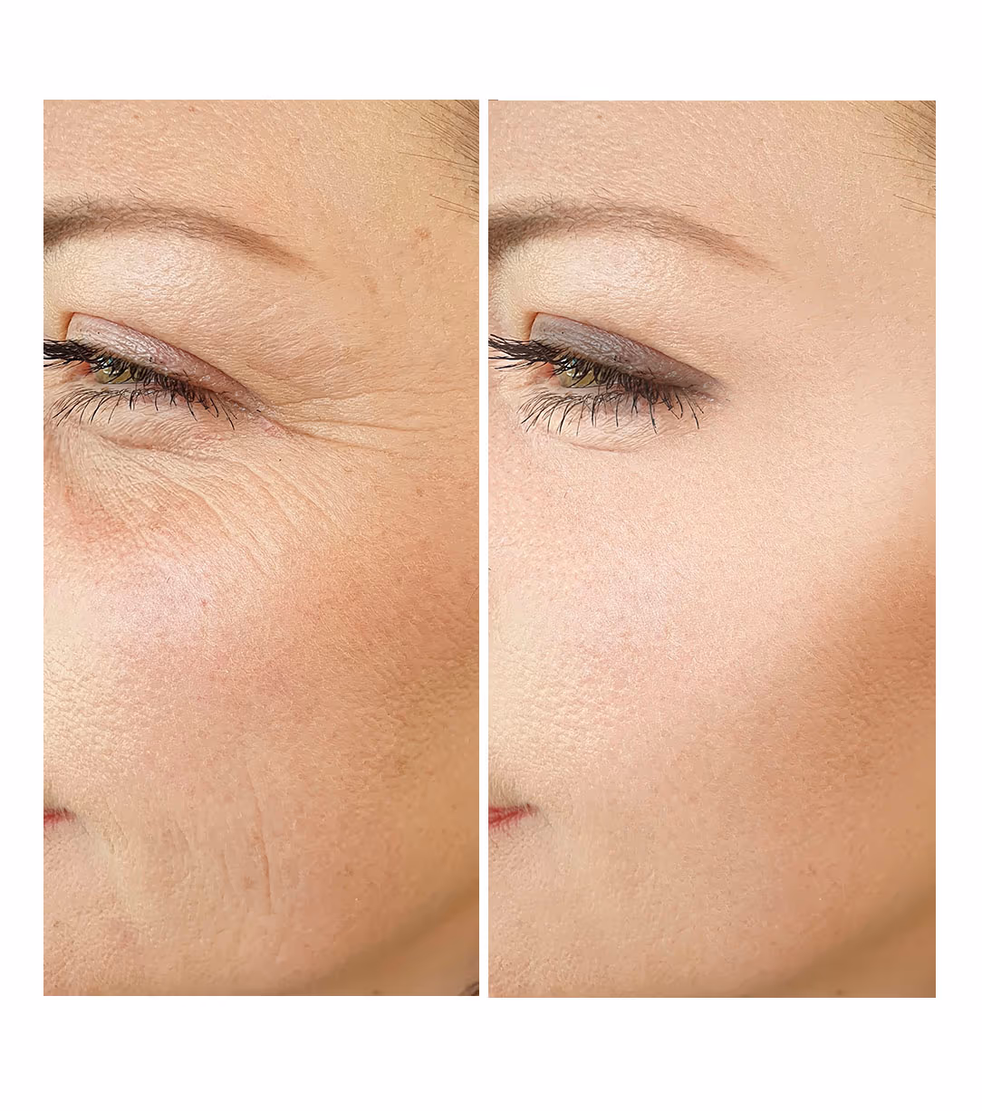 Kanpeki Dermasyl Sensiace 1
