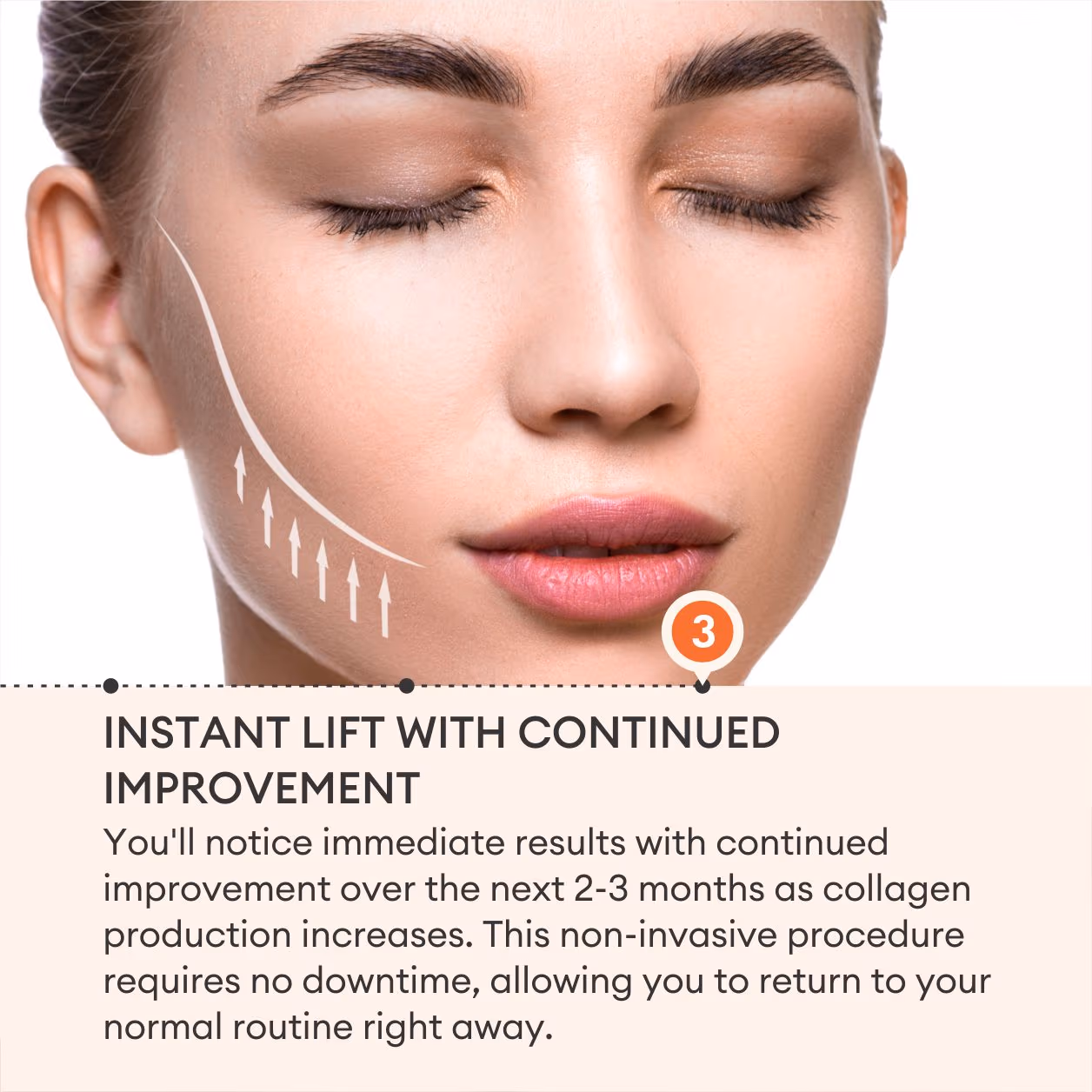 Ultraformer 5