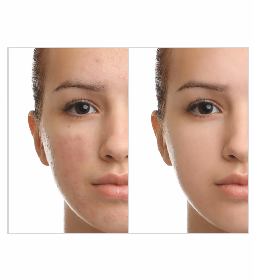 Facial 1