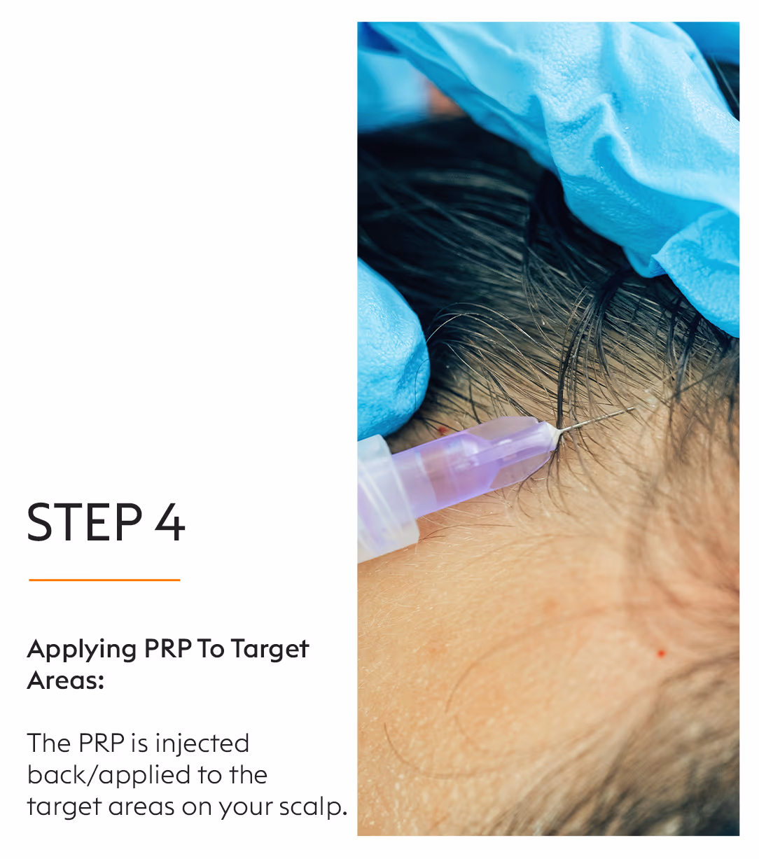 Face PRP 6