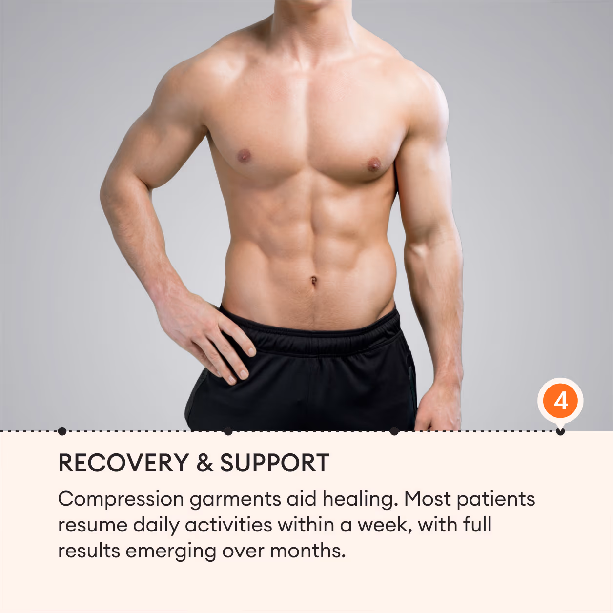 Gynecomastia Surgery 7
