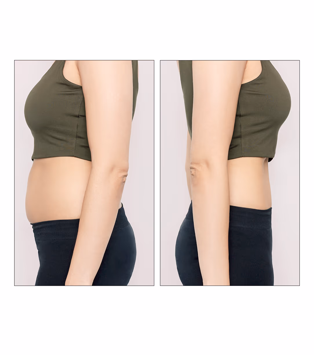 Lipolaser Body Slimming Treatment 1