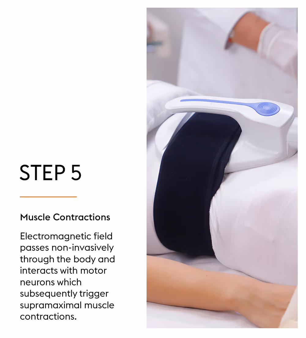 M-Tone Skin & Muscle Toning Treatment 7