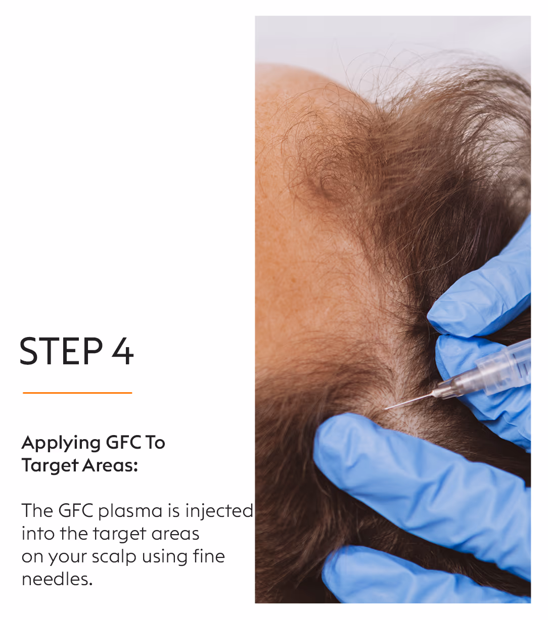 GFC Hair Fall Treatment 6