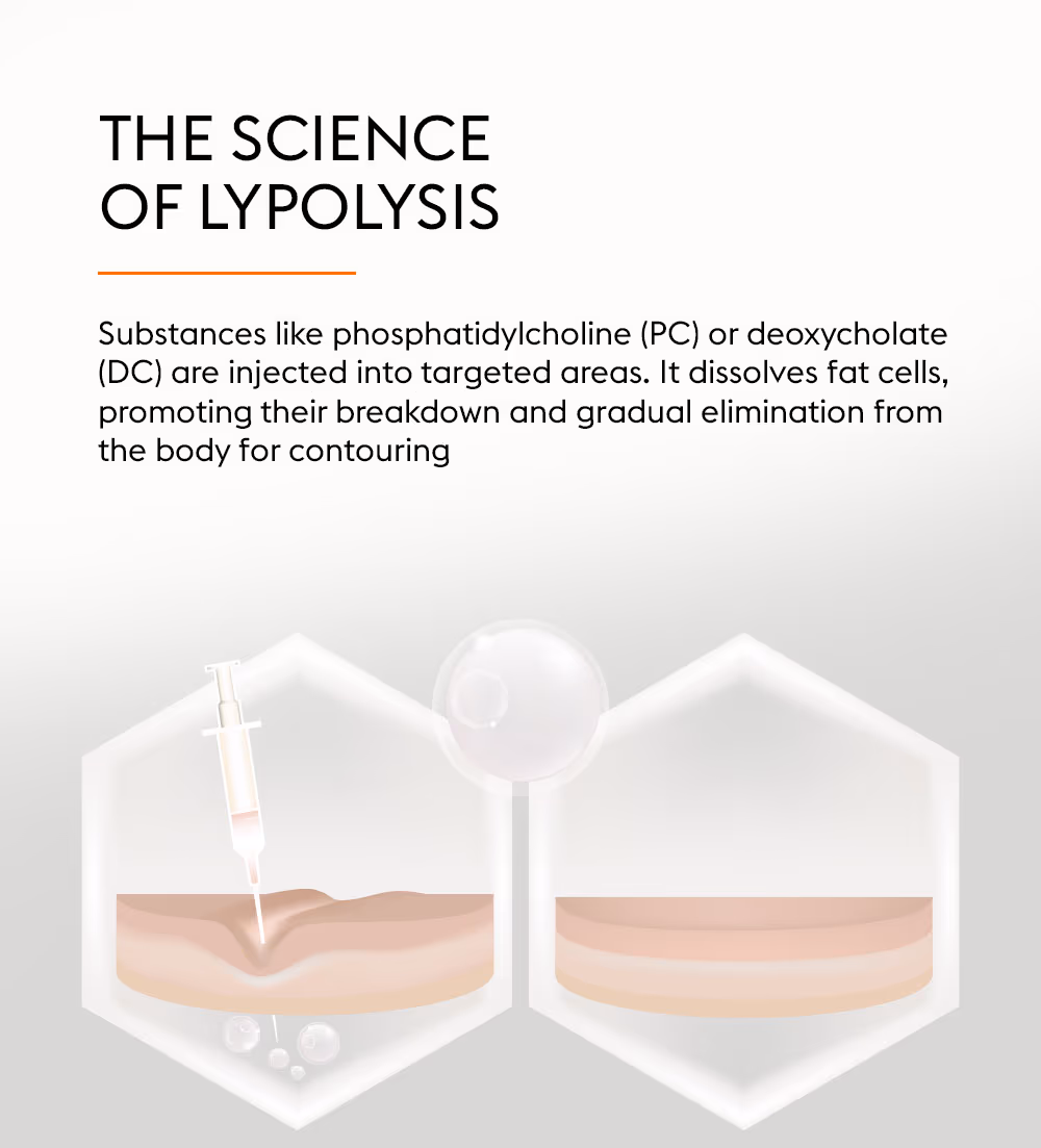 Lypolysis 2