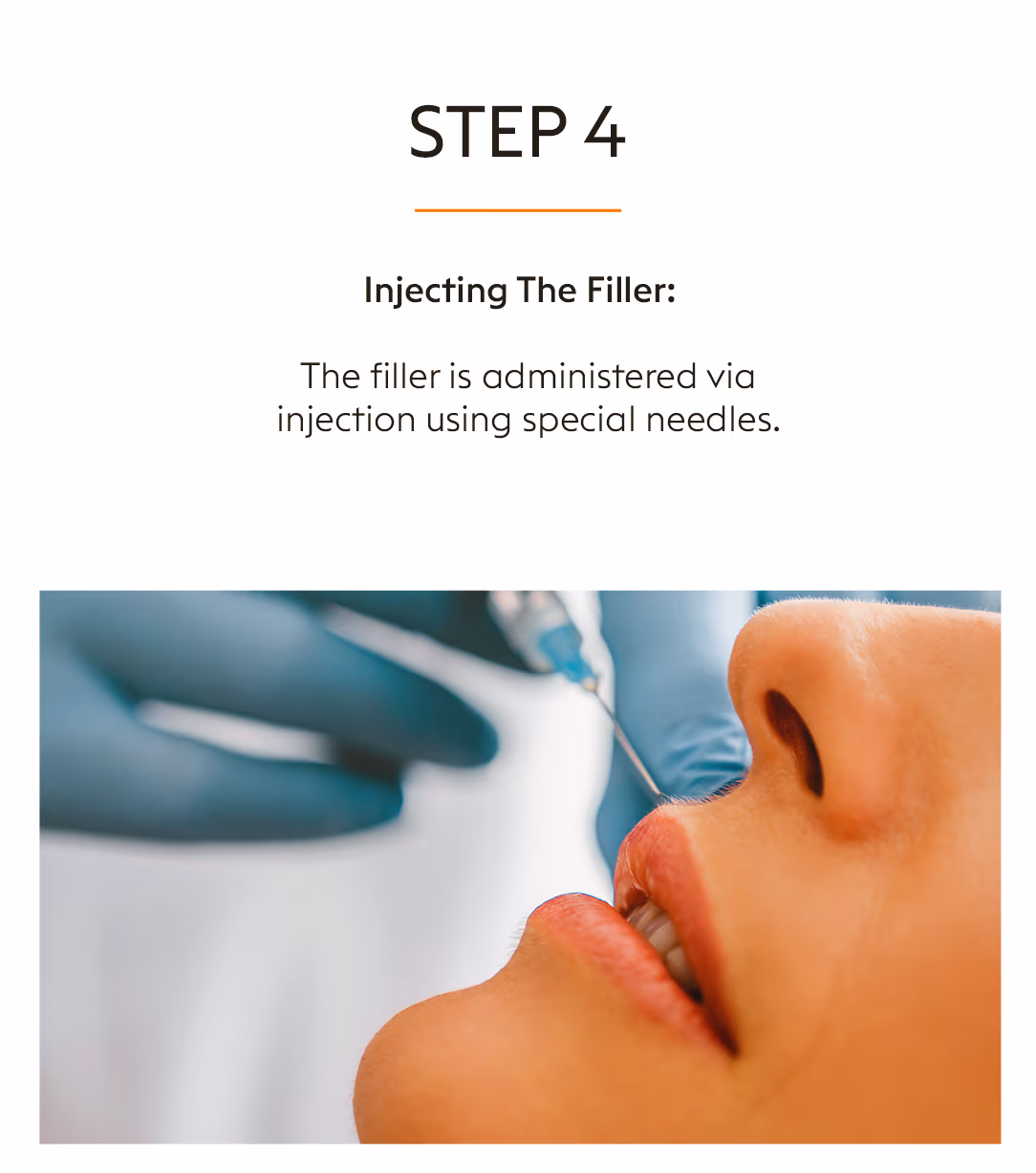 Face Fillers Injection Treatment 6