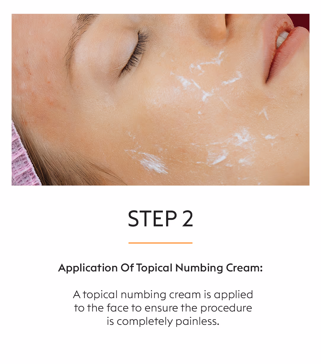 GFC Skin Whitening Treatment 4