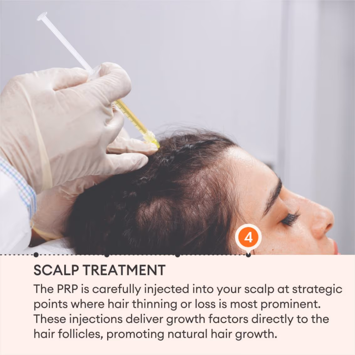 Hair PRP 6