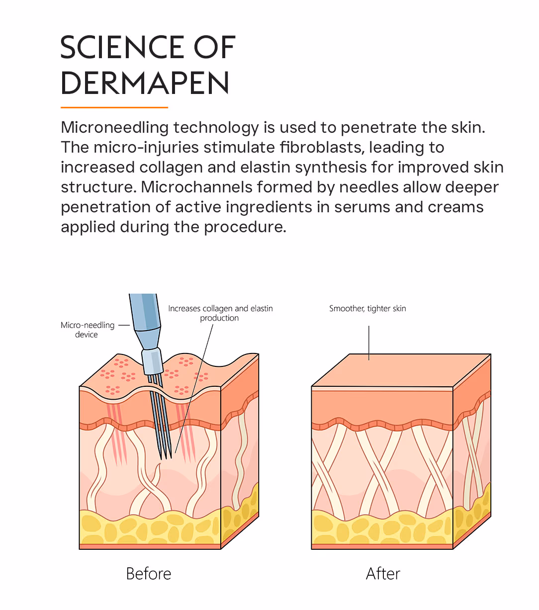 Dermapen Microneedling Treatment 2