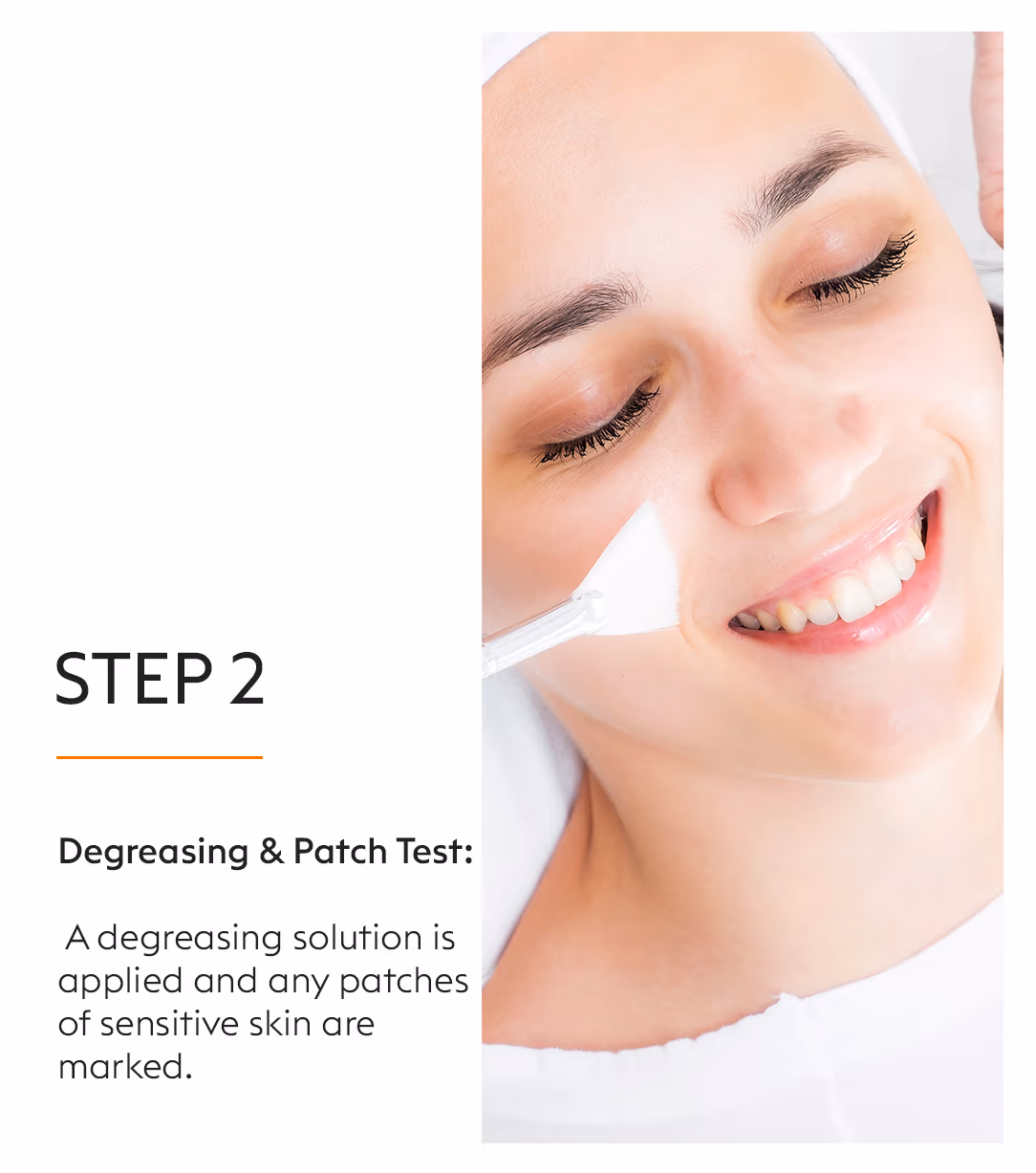 Chemical Peels Acne Scars Treatment 7