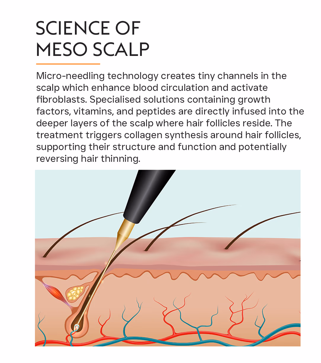 Meso Scalp 2