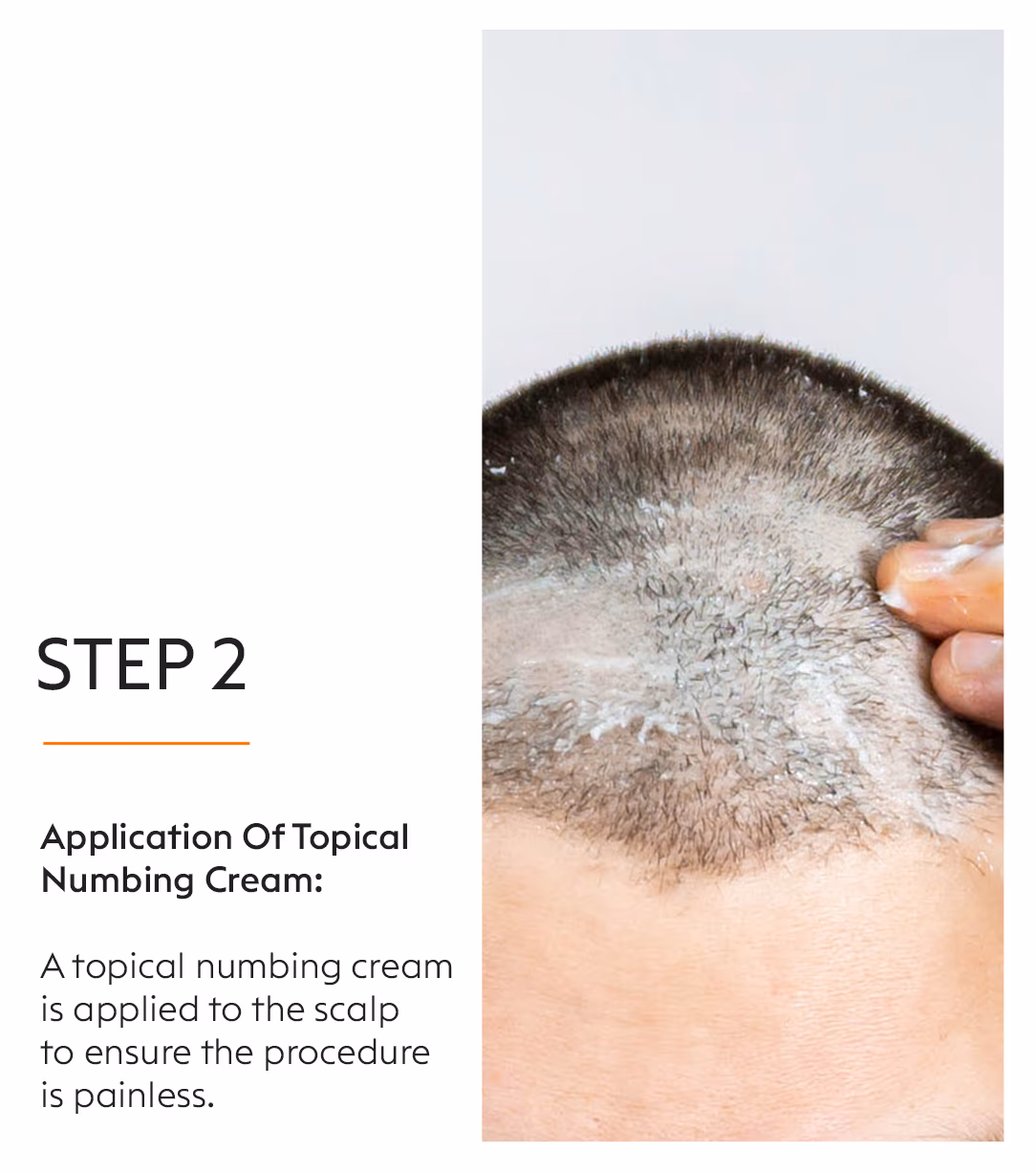 GFC Hair Fall Treatment 4