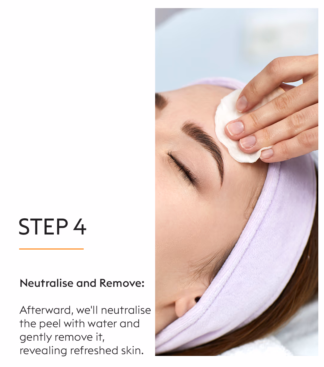 TCA Chemical Peels Skin Whitening Treatment 6