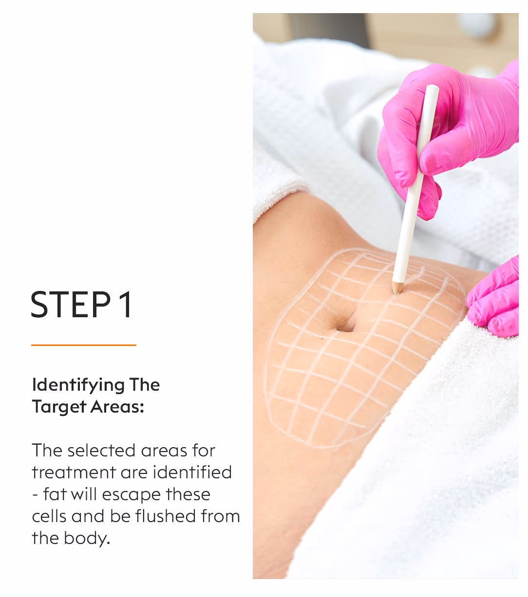 Lipolaser Body Slimming Treatment 3