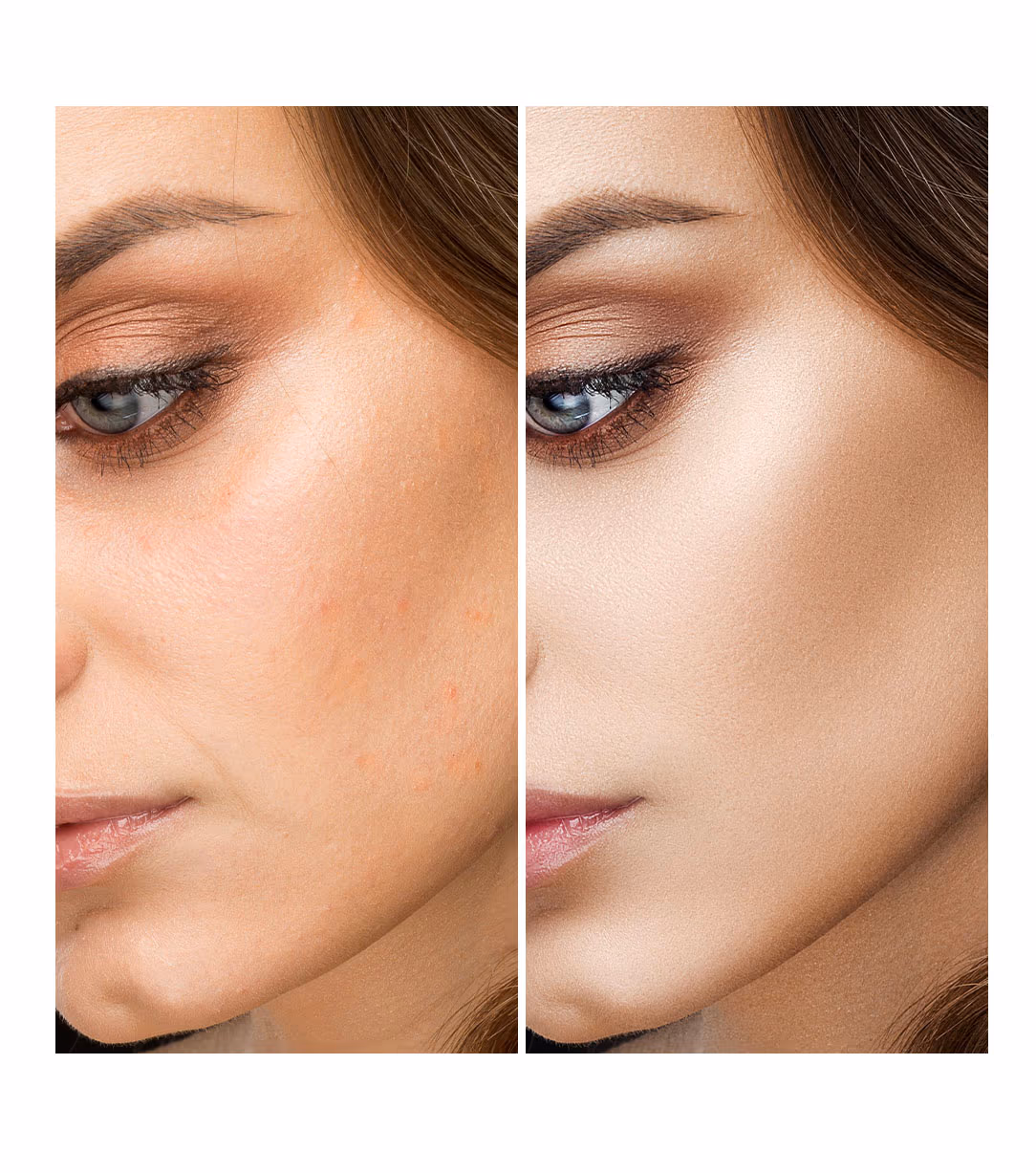 Golden Peel 1