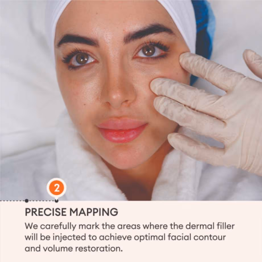 Dermal Fillers 4
