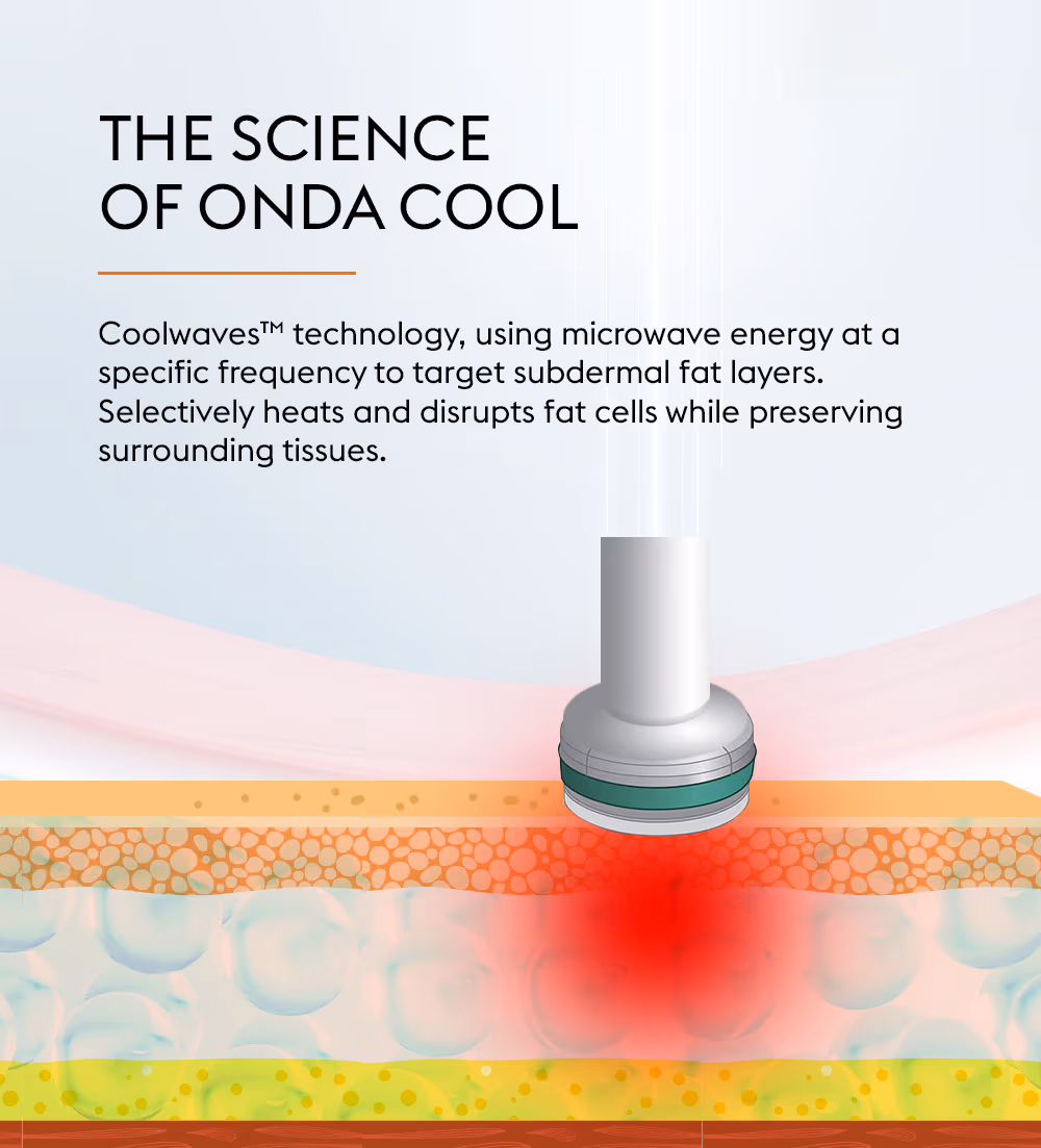 Onda Cool 2