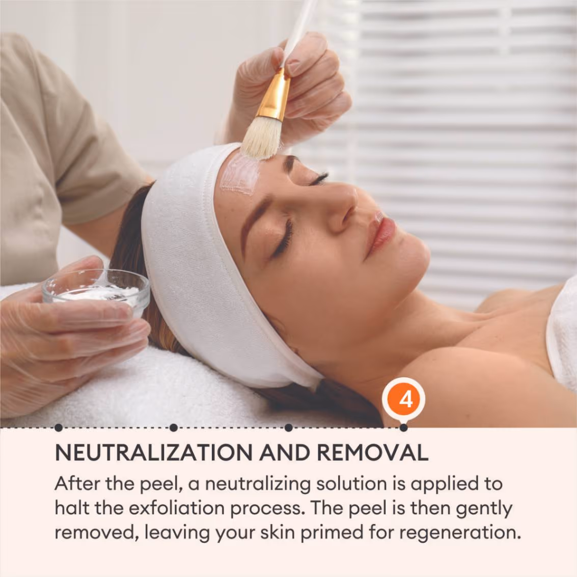 Chemical Peels 6