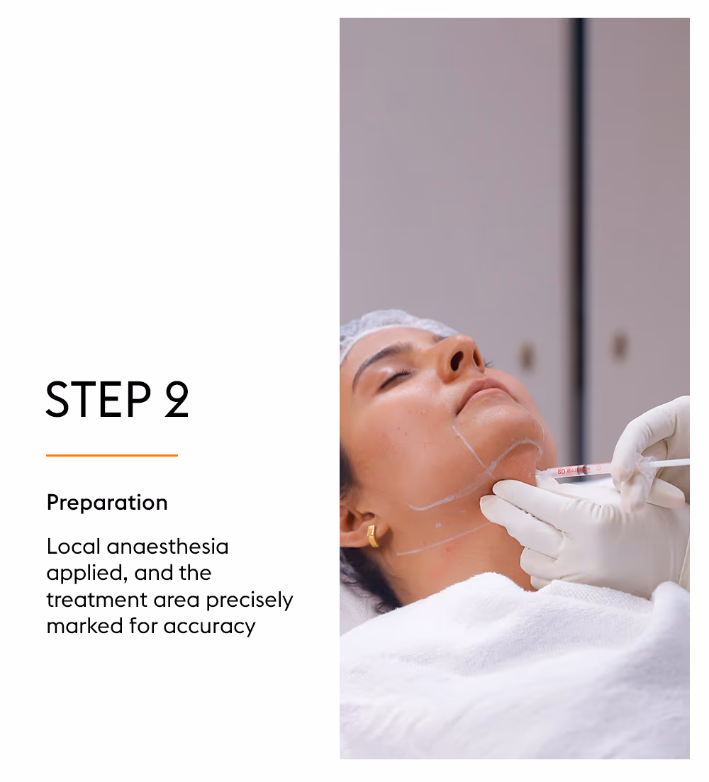 Lypolysis 4