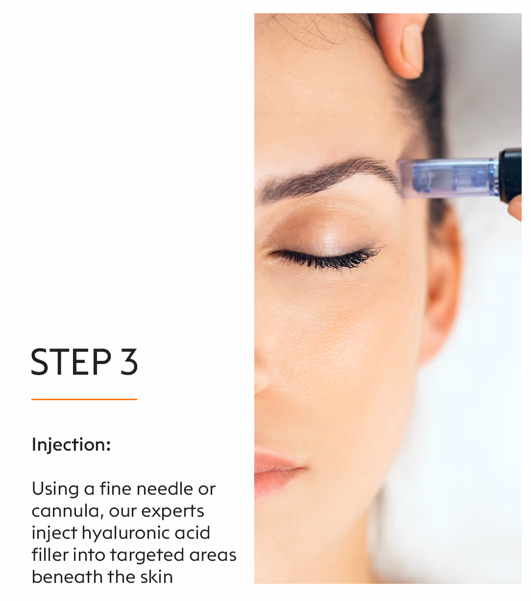 HA Skin Boosters 5