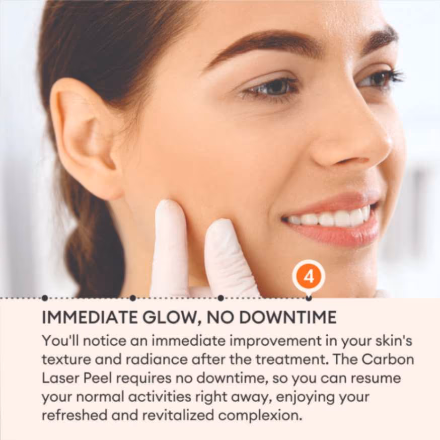 Carbon Laser Peel 6