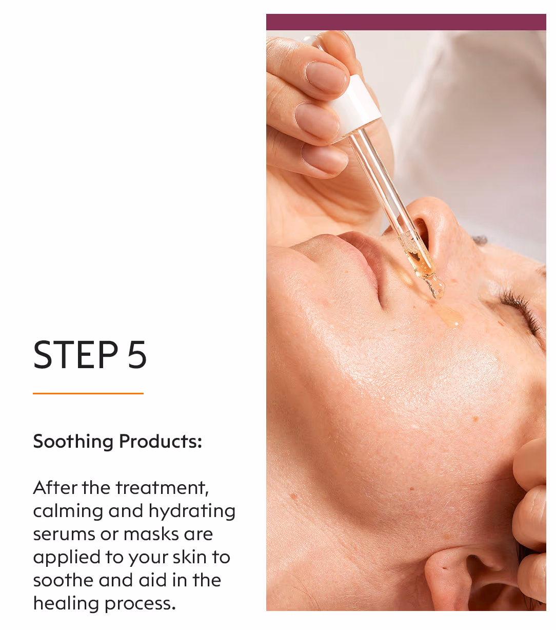 Dermapen Microneedling Treatment 7