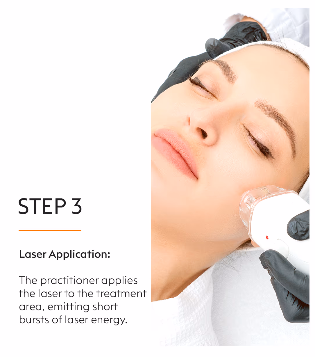 Full Body Laser Hair Removal Treatment 5