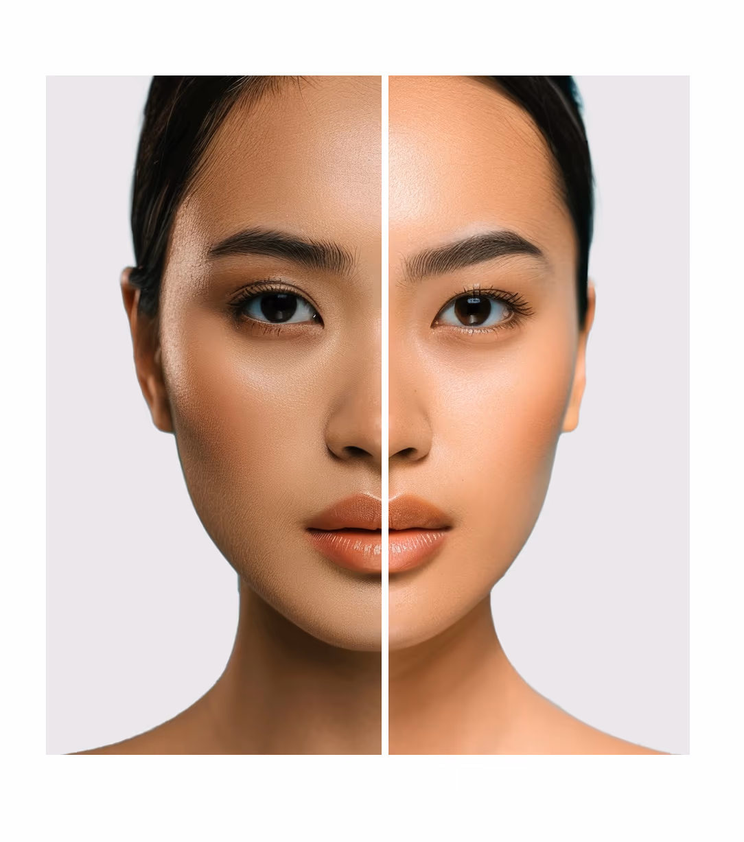 Enzymacid Facial 1