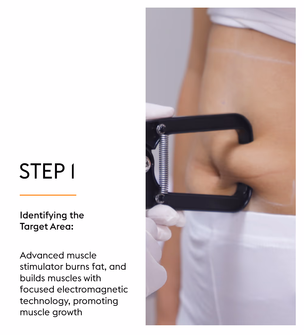M-Tone Skin & Muscle Toning Treatment 3