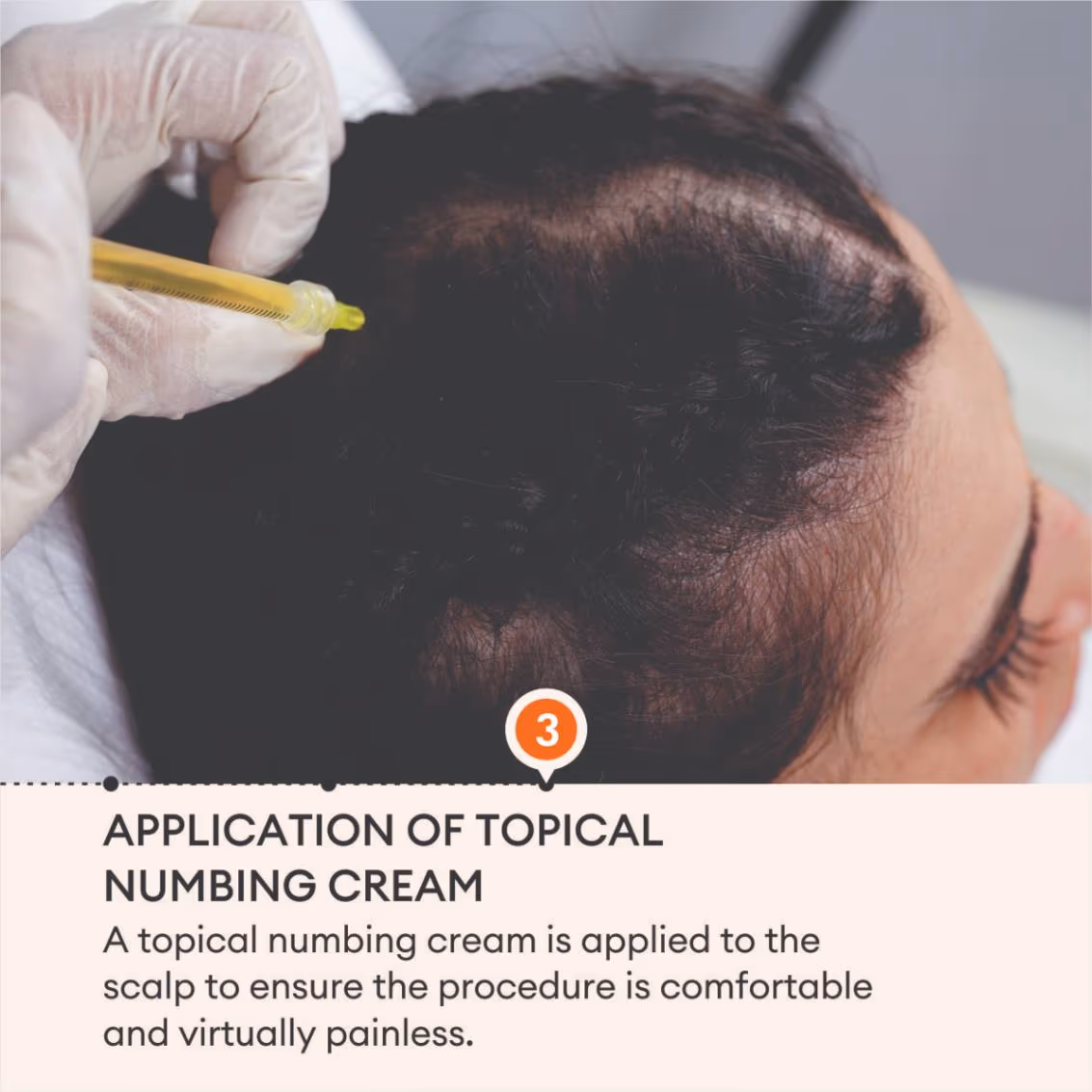Hair PRP 5