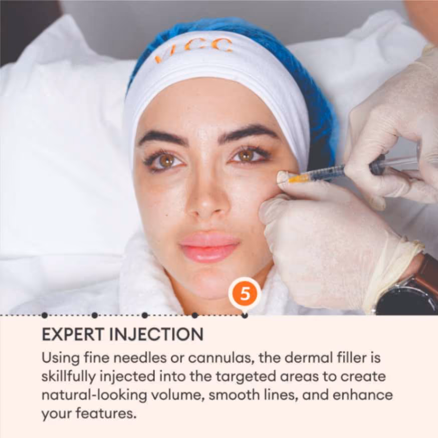 Dermal Fillers 7