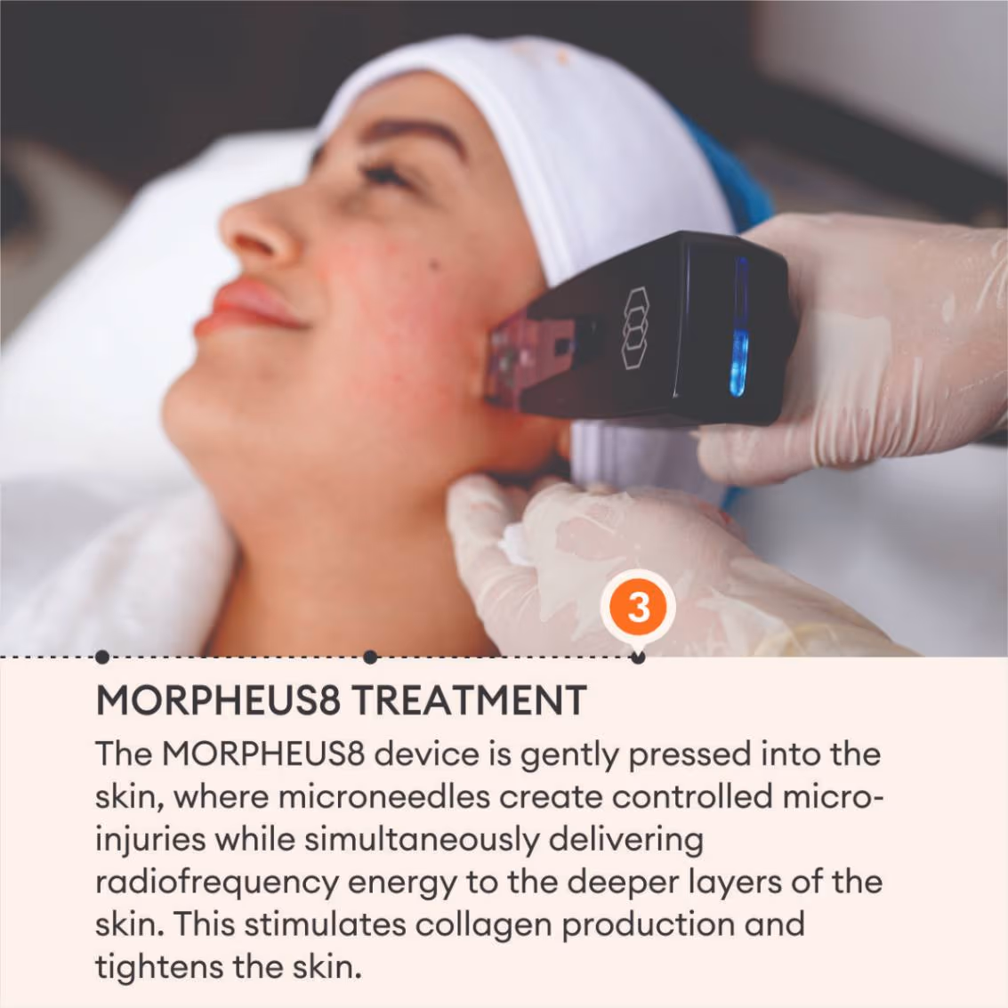 Morpheus 5