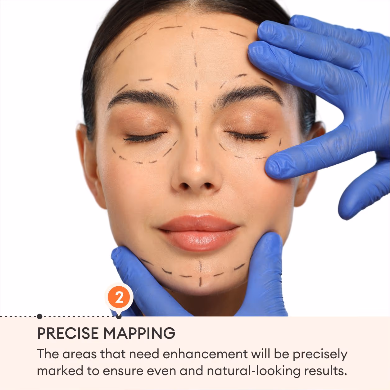 3D Filler 4
