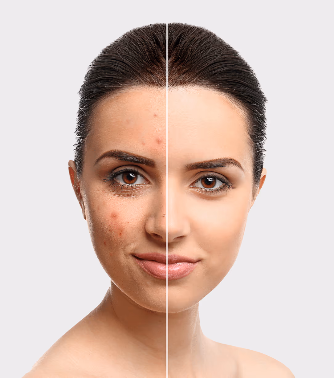 Skin Cosmedermat 1