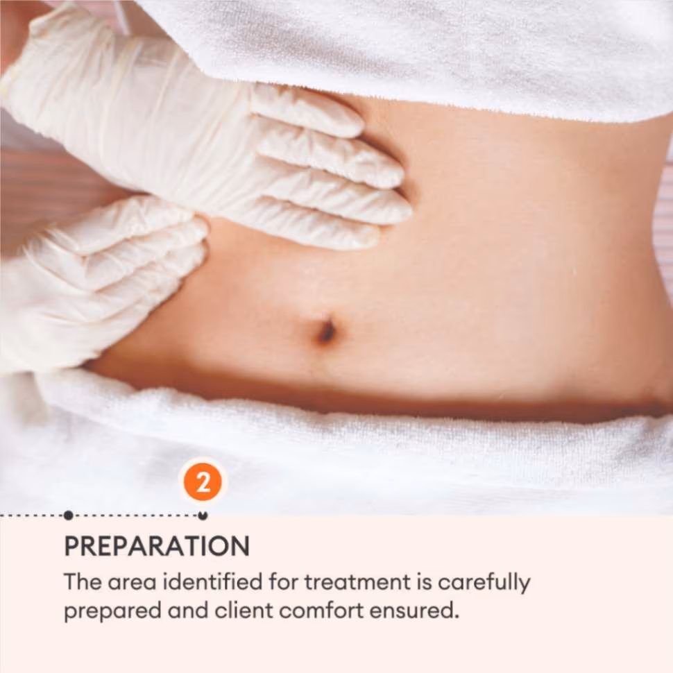 Gel Therapy 4